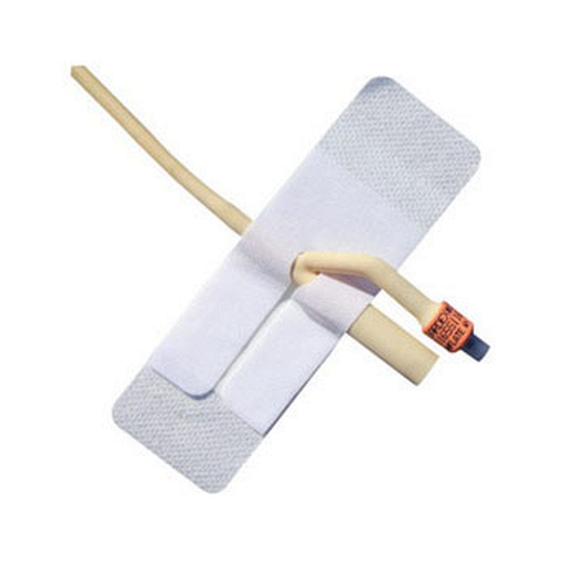 Adhesive Foley Catheter Anchoring Device.  One Size Fits All.  Non-sterile